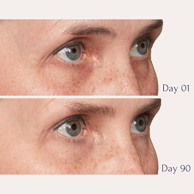 Tru Alchemy Eye Elixir Cooling Eye Treatment Cream - Dark Circle Eye Cream for Puffiness and Bags Under Eyes - Caffeine, Hyaluronic Acid, Vitamin C