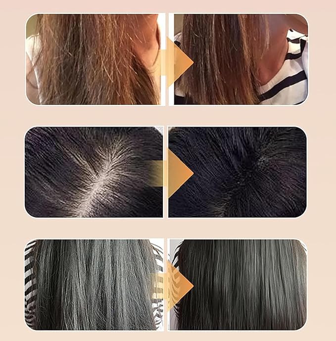 Professional Hair Treatment Set with Caviar Peptide Volumizing Shampoo, Maca Collagen Repair Mask and Maca Essence Oil -Dandruff Treatment,Controls Oil, Soothes Scalp for Dry Damaged All Hair Types