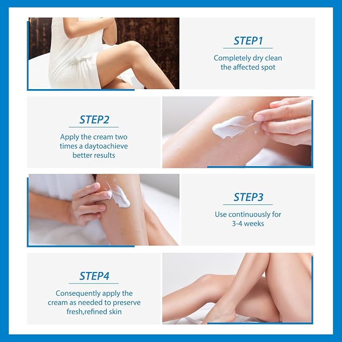 Urea Cream 40 Percent for Feet,40% Urea 2% Salicylic Acid Foot Cream,Foot Cream and Hand Cream with Cocos Nucifera Oil,Tea Tree,Aloe Vera,Vitamin E (5.29 OZ/150g)