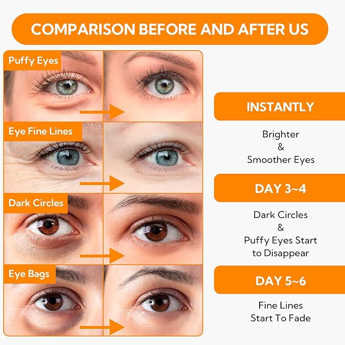 Vitamin C Under Eye Patches(30 Pairs) -Cooling Eye Masks for Dark Circles, with Caffeine Niacinamide Hydra-Gel Collagen, Puffy Eyes & Eye Bags Treatment, Fine Lines & Wrinkles Reduce, Anti-Aging