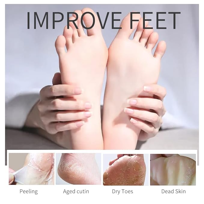 6Pairs Hand Foot Peel Mask Set, Foot Peeling Mask for Dry Cracked Foot Care Hydrating, Foot Peel Exfoliating Feet Peeling Masks 4pcs + hand peel masks, for Women Remove Dead Skin Hand Foot Masks
