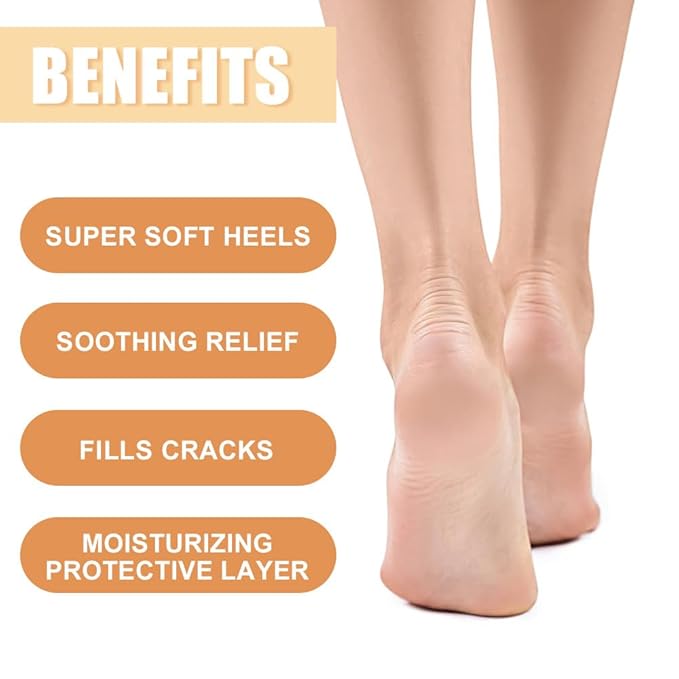 60% Urea Hydrating and Anti-Cracking Foot Cream, Foot Therapy Balm, Moisturising and Relieves Cracking and Dryness Foot Cream, Dry Cracked Heels and Feet Women Men (Honey, 1.4 Ounce)
