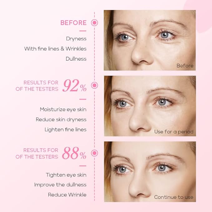 AKARY Cherry Blossom Eye Roller Serum Eye Moisturizer, Deep Hydration Eye Serum with Caffeine and Sodium Hyaluronate, Under Eye Cream to Reduce Dark Circles, Fine Lines, Smoothing Skin Care Treatment