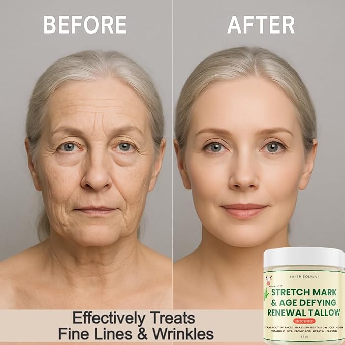 Stretch Mark & Age Defying Renewal Tallow – Yam Root, Coll-agen, Biotin, Vitamin C, Dead Sea Minerals, Hyaluronic Acid, Keratin & Elastin (8 fl oz, Lavender)