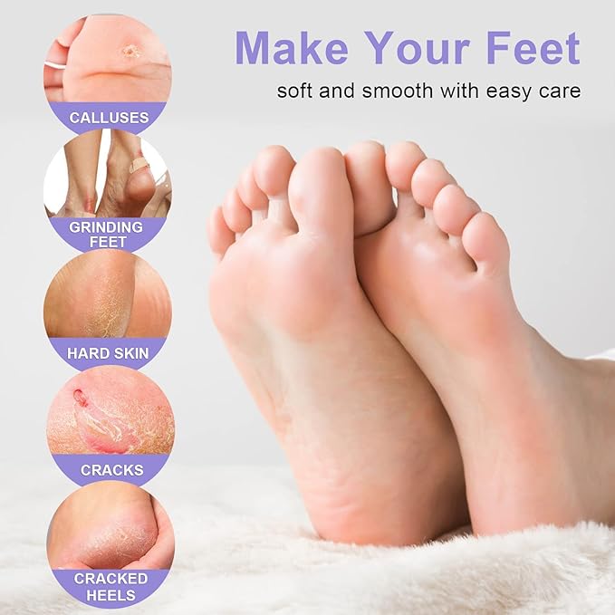 Foot Peel Mask Exfoliant for Peeling Off Calluses, Natural Exfoliator for Callus, Dry Dead Skin, Repair Rough Heels
