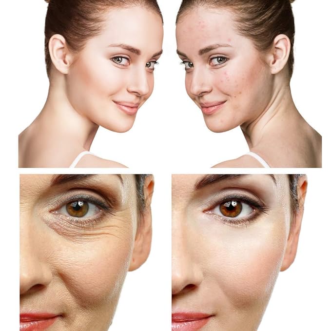 Dead Sea Mineral Mud Mask Scented with Lavender for Face and Body - 100% Natural Minerals - Minimize Pores, Removes Blackheads and Wrinkles for Men and Women, a Healthier Complexion 8.8 oz