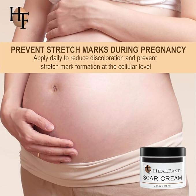 The Original Scar Cream for Stretch Marks – Soothes, Nourishes and Refreshes Skin – Using Ovasome Technology with Allantoin & Alpha LIpoic Acid – 2 Oz/ 60 ml