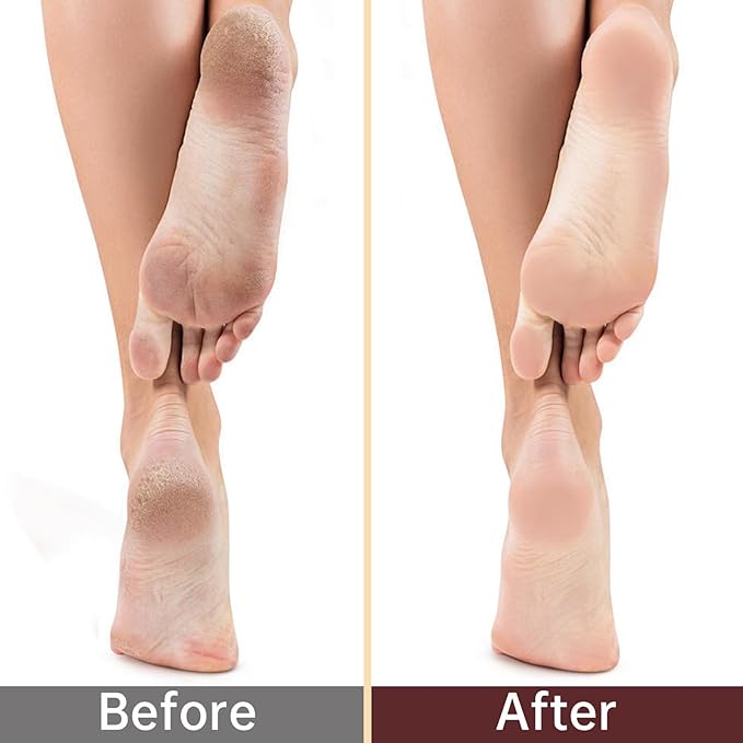 BLMHTWO 4 Pairs Moisturizing Socks, Overnight Foot Care, For Dry Cracked Feet, White Cotton