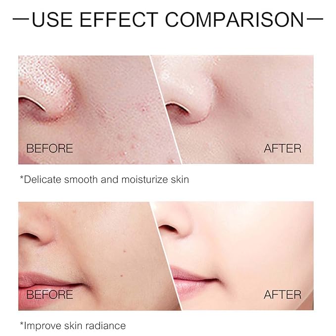 O’KADY Face Skincare Sets Anti Aging Beauty Products Skin Care 6-piece For Women Skincare Kits With Cleanser,Toner,Serum,Eye Cream,Lotion,Facial Cream,Primer Cream Travel Kit For Wife Mom