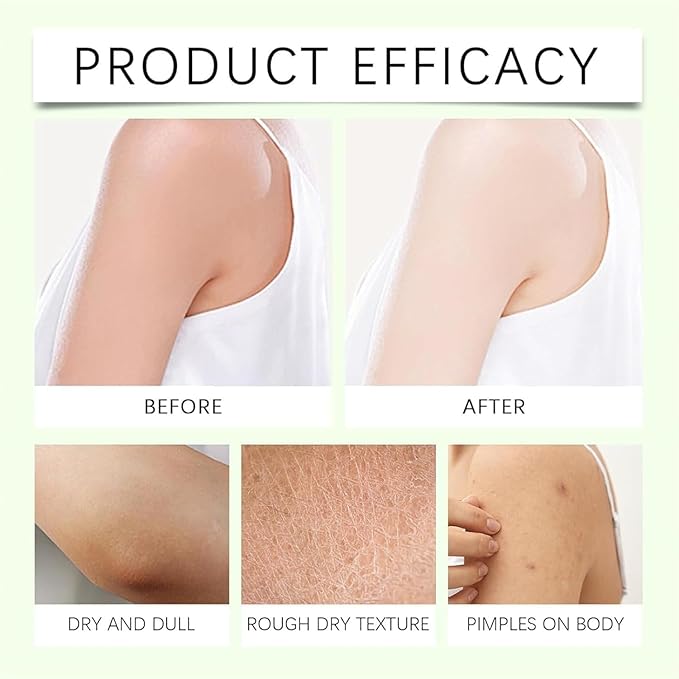 Mama-Bear Neuropathy Cream, Magnesium Body Butter, Magnesium Cream for Neuropathy, Deeply Moisturizes Skin, Keep Soft Smooth (2PCS)