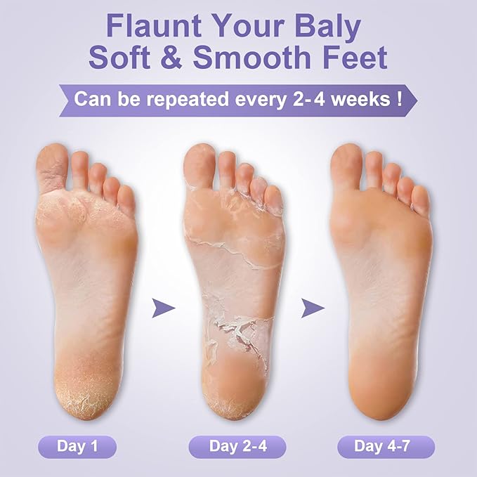 Foot Peel Mask Exfoliant for Peeling Off Calluses, Natural Exfoliator for Callus, Dry Dead Skin, Repair Rough Heels