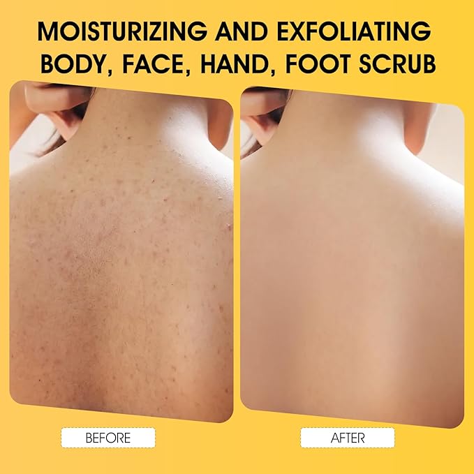 Body Scrub,Turmeric Exfoliating Body Scrub with AHA & BHA, Gentle Body Exfoliator with Vitamin C for Body Hand Foot Bikini Area, Smooth & Moisturized Skin for Women and Men - 11.3oz