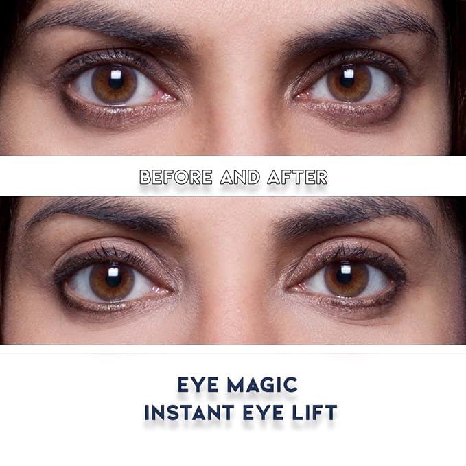 Eye Magic Premium Eyelid Lift (L/XL Kit + Gel) Made in America Lifts and Defines Droopy, Sagging or Hooded Eyes Safe For Daily Use