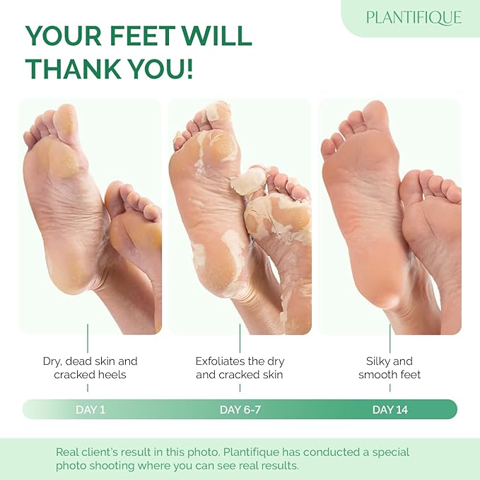 PLANTIFIQUE Foot Peeling Mask 1 Pair | Dermatologically Tested Repairs Heels & Removes Dry Dead Skin for Baby Soft Feet | Exfoliating Foot Peel Mask for Dry Cracked Feet | Jasmine