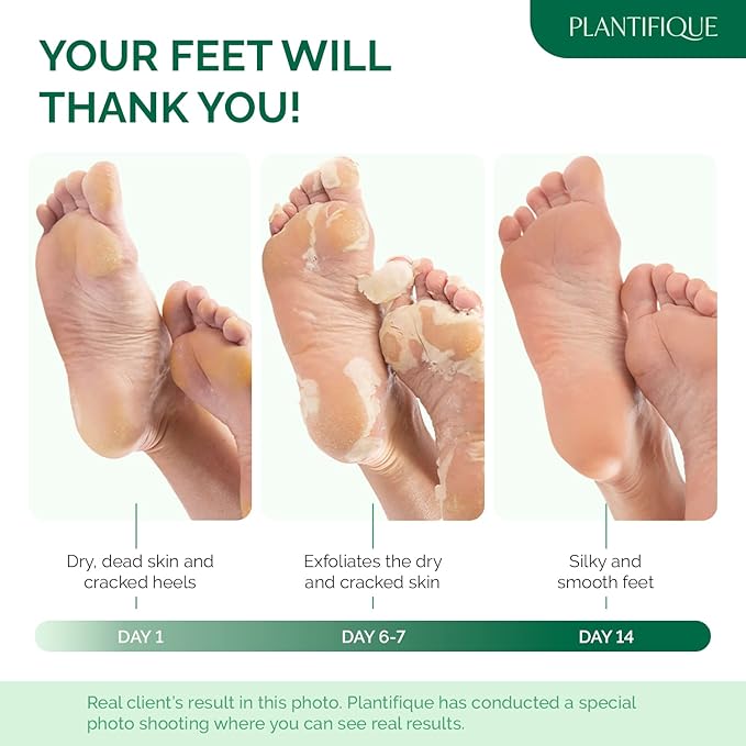 PLANTIFIQUE Foot Peeling Mask 2 Pack for Men | Dermatologically Tested Repairs Heels & Removes Dry Dead Skin for Baby Soft Feet | Exfoliating Foot Peel Mask for Dry Cracked Feet | Aloe Vera