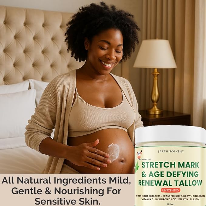 Stretch Mark & Age Defying Renewal Tallow – Yam Root, Coll-agen, Biotin, Vitamin C, Dead Sea Minerals, Hyaluronic Acid, Keratin & Elastin (8 fl oz, Vanilla)