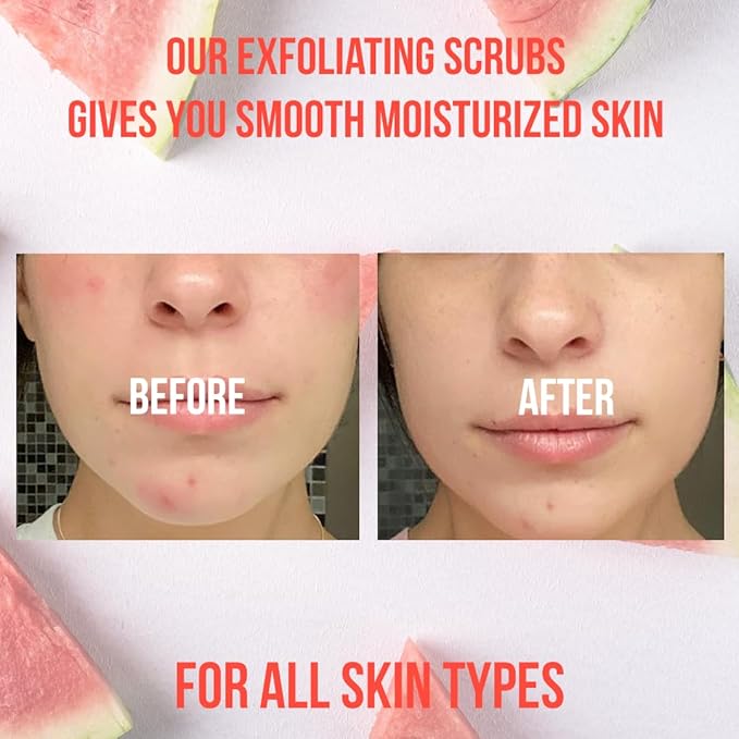 Organic Pink Watermelon Body Scrub, Pure Natural Gentle Exfoliator For Smooth & Soft Skin, Best Shower Exfoliating Salt Skincare Scrub, Hydrating & Moisturizing Face Foot Hands, Great Gift for Women