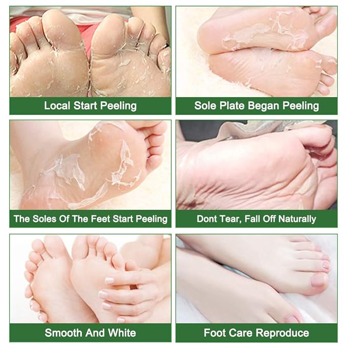 Foot Peeling Mask Moisturizing Socks 5Pairs, Foot Mask Remove Dead Skin, Rough Callus and Cracked Heels, Dry Skin Moisturizer for Soft and Smooth Baby Touch Feet (Tea Tree)