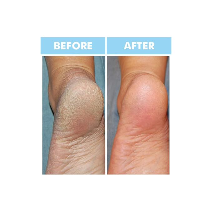 Bodipure Premium Keratin Foot Mask Socks | at Home Spa Moisturizer Socks for Dry Cracked Feet, Callus & Heel Softening | Easy-to-Use Pedicure Foot Repair | Chemical-Free Feet Treatment | 50 Pairs