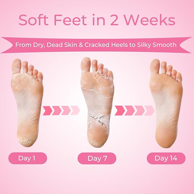 Foot Peeling Mask, 4 Pairs Foot Peel Mask for Dry Cracked Feet, Dead Skin Callus Removal, Repair Soft Feet
