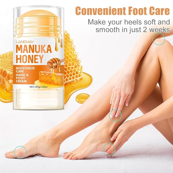 60% Urea Hydrating and Anti-Cracking Foot Cream, Foot Therapy Balm, Moisturising and Relieves Cracking and Dryness Foot Cream, Dry Cracked Heels and Feet Women Men (Honey, 1.4 Ounce)