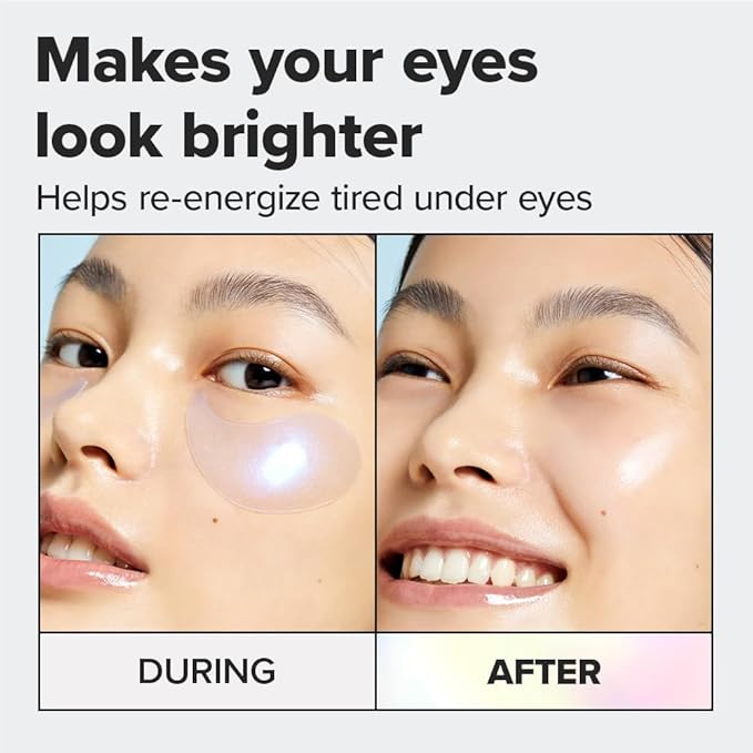 I DEW CARE Hydrogel Eye Patch - Starlit Kitten | Korean Under Eye Patches for dark circles and puffy eyes, Smooths Puffy Eyes, Eye wrinkle patches, Dermatologically Tested, (5 EA)