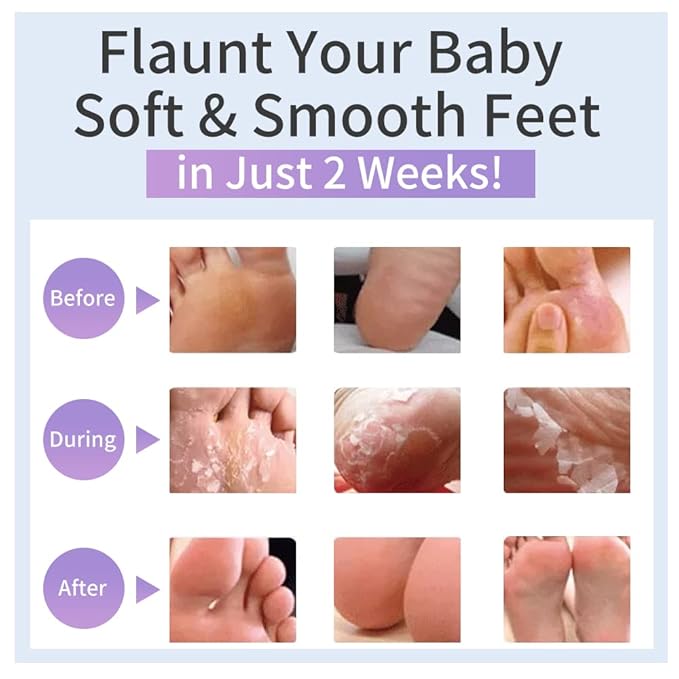 6Pairs Hand Foot Peel Mask Set, Foot Peeling Mask for Dry Cracked Foot Care Hydrating, Foot Peel Exfoliating Feet Peeling Masks 4pcs + hand peel masks, for Women Remove Dead Skin Hand Foot Masks