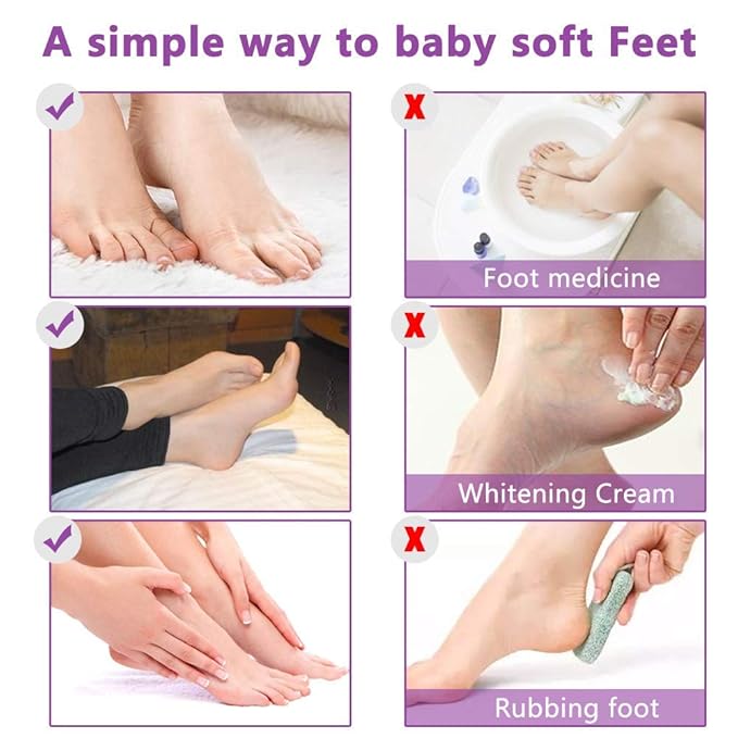Foot Peeling Mask - 5 Pack, Exfoliating Mask Make Feet Baby Soft, Foot Mask for Dry Cracked Skin, Peeling Away Dead Skin, Calluses - Lavender