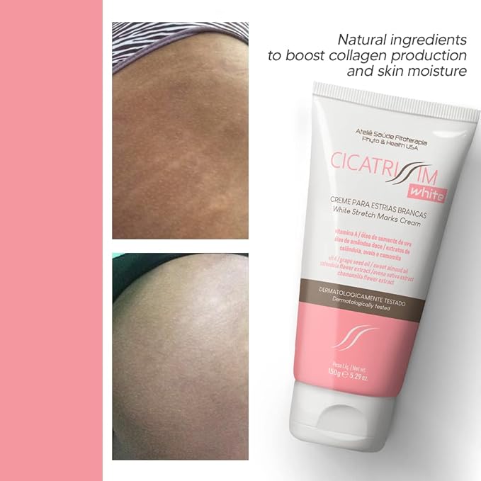 Cicatrissim White Stretch Mark Fade and Removal Cream - Innovative Formula With Pure and Powerful Natural Ingredients From Brazilian Flora - For All Skin Types.
