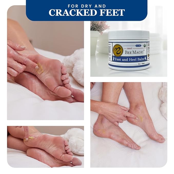 Sweet Bee Naturals Organic All Natural Foot and Heel Balm 3 (2 OZ Jars). For Dry and Cracked Feet Repair. Organic Salve Moisturizer for Heel Care & Callus Treatment. Made in USA. 3 Jars (6 OZ)