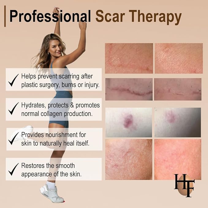 The Original Scar Cream for Stretch Marks – Soothes, Nourishes and Refreshes Skin – Using Ovasome Technology with Allantoin & Alpha LIpoic Acid – 2 Oz/ 60 ml