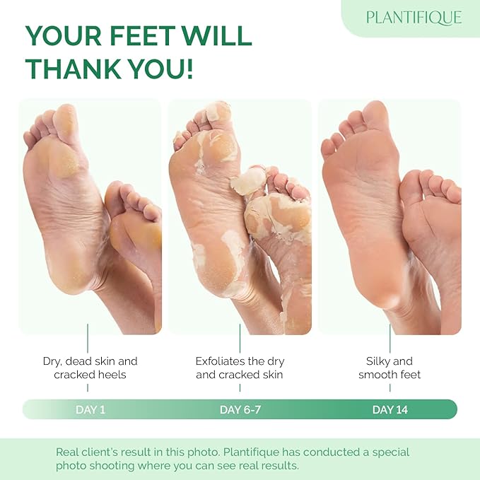 PLANTIFIQUE Foot Peeling Mask 2 Pack | Dermatologically Tested Repairs Heels & Removes Dry Dead Skin for Baby Soft Feet | Exfoliating Foot Peel Mask for Dry Cracked Feet | Lavender