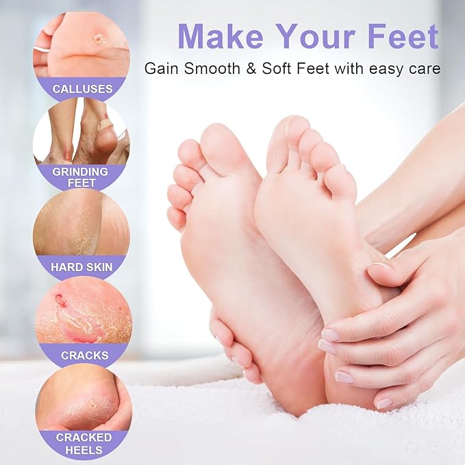 Foot Peel Mask Exfoliant for Peeling Off Calluses, Natural Exfoliator for Callus, Dry Dead Skin, Repair Rough Heels
