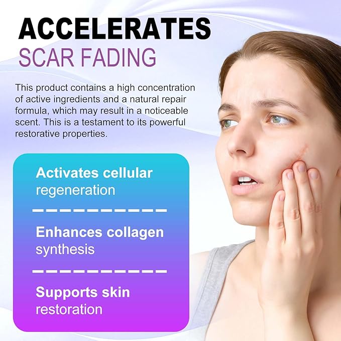 Silicone Scar Gel - 16.5% Complex Active Repair Scar Cream, 2.1 oz for Stretch Marks & Surgical Scar Treatment, Keloid Care for All Skin Types. Effective on New & Old Scars, Pregnancy, Keloids-Purple