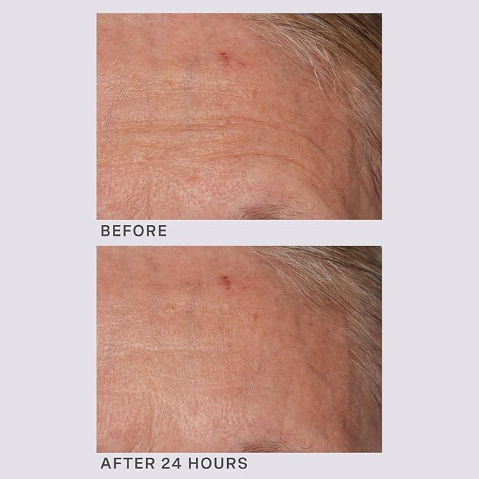 Lancer Gravity Defying Moisturizer With Firming Technology, Face Moisturizer for Women, Great at Boosting Collagen, Hydration, Anti-Aging and Firmness