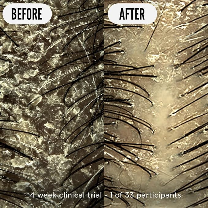 Noughty 97% Natural Care Taker Scalp Soothing Tonic, for Sensitive and Irritated Scalps, Fragrance Free Leave in Treatment, Gentle on Skin and Hair, Sulphate Free Vegan Haircare 75ml