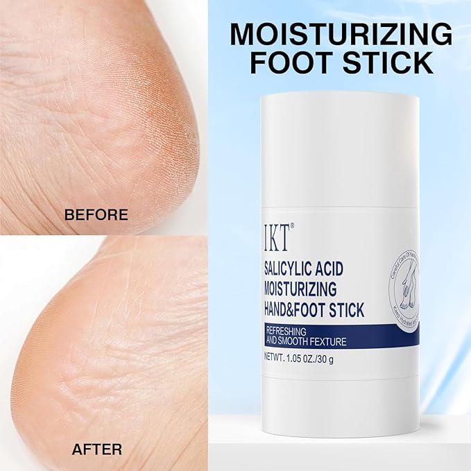 Foot Cream Stick for Dry Cracked Heels,Moisturizing Balm with Salicylic Acid & Olive Oil,Roll-On Repair Treatment for Rough Feet, Hands & Elbows,No Mess Foot Lotion Alternative,1.05 oz,1 pack