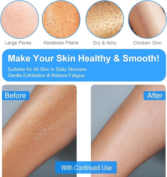 Exfoliating Gloves 2 Pcs, Exfoliating Body Scrubber for Bath Shower Exfoliation, Body Scrub Exfoliator Loofah Sponge for Dead Skin Remover, Korean Exfoliating Mitt (Blue)