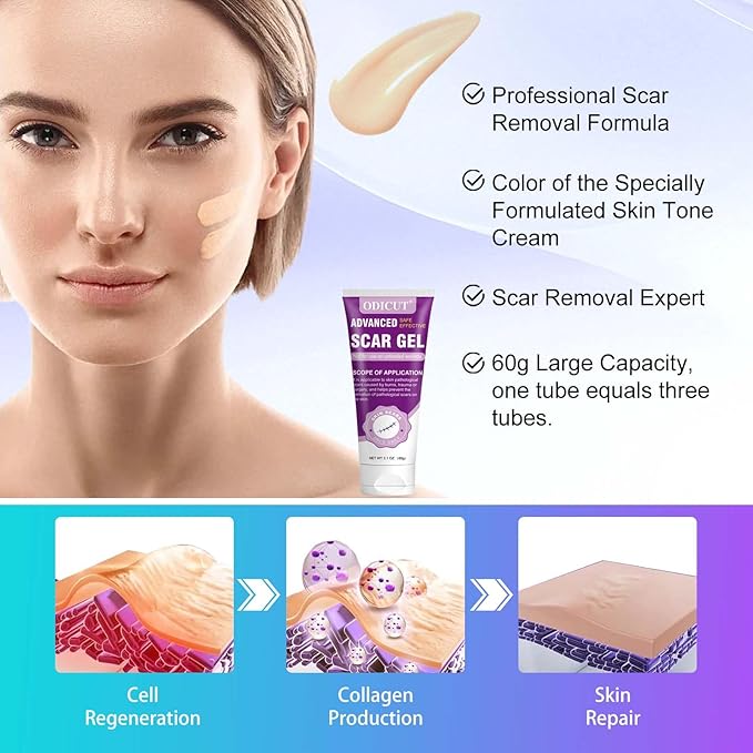 Silicone Scar Gel - 16.5% Complex Active Repair Scar Cream, 2.1 oz for Stretch Marks & Surgical Scar Treatment, Keloid Care for All Skin Types. Effective on New & Old Scars, Pregnancy, Keloids-Purple