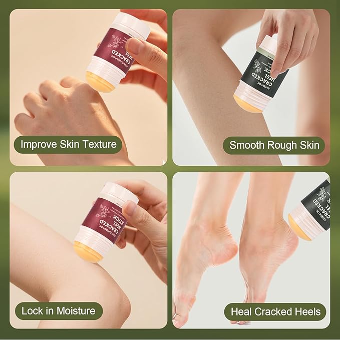 4 Pcs Cracked Heel Treatment & Repair Stick Set (with 2 Foot Balms + 2 Heel Socks) – Rose Oil & Jojoba Oil Infused cracked heel stick Balm for Dry, Cracked Heels – No-Mess Applicator, Travel-Friendly