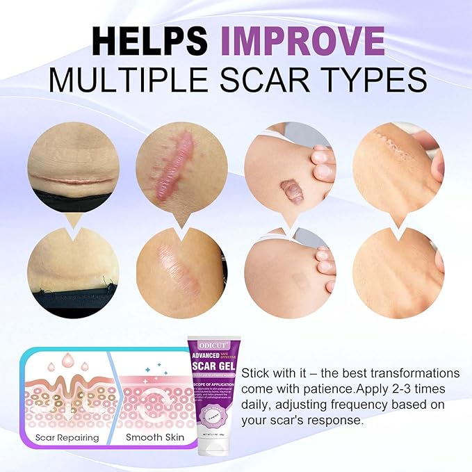 Silicone Scar Gel - 16.5% Complex Active Repair Scar Cream, 2.1 oz for Stretch Marks & Surgical Scar Treatment, Keloid Care for All Skin Types. Effective on New & Old Scars, Pregnancy, Keloids-Purple
