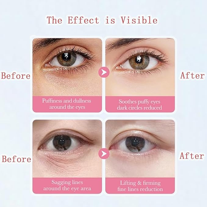 Under Eye Patches for Dark Circles, Puffiness and Eye Bags, Eye Mask,Wrinkle Treatment Anti-Aging Rejuvenating Moisturizing Skin Care 60PCS Collagen Eye Gel Pads Anti-Wrinkle Eye Patches