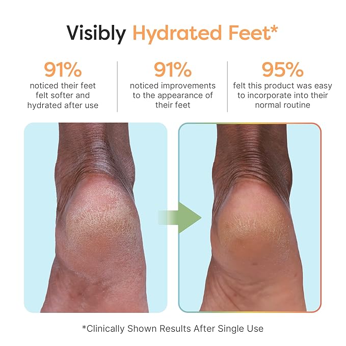 ZenToes Moisturizing Foot Mask for Dry Cracked Feet | Shea Butter, Jojoba Oil & Squalane Infused Hydrating Sheet Masks | Spa Experience At Home | Mess Free Design | Vanilla Citrus Scented, 1 Pair