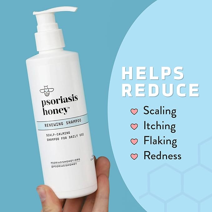Renewing Shampoo - Itchy & Dry Scalp Treatment - Psoriasis Shampoo With Argan Oil for Women & Men - Scalp Psoriasis Relief - Daily Hair Shampoo for Kids (8oz)