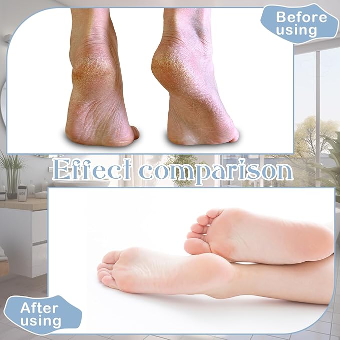 12 Pairs Moisturizing Socks Overnight for Dry Feet Cotton Spa Lotion Cotton Moisture Enhancing Cosmetic Moisturizing Socks for Women Men Foot Care Dry Cracked Feet (Bright,Mix Color)