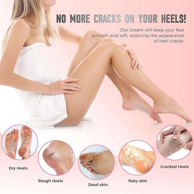 VANERIA Cracked Heel Repair Stick,Heel Balm for Dry Cracked Feet Treatment with Shea Butter & Coconut Oil,Deeply Moisturize & Soften Feet,Exfoliates Dead Skin 40g(Peach Scent)