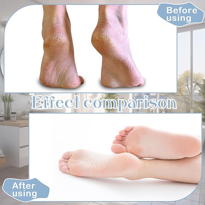 12 Pairs Moisturizing Socks Overnight for Dry Feet Cotton Spa Lotion Cotton Moisture Enhancing Cosmetic Moisturizing Socks for Women Men Foot Care Dry Cracked Feet(Beautiful,White)