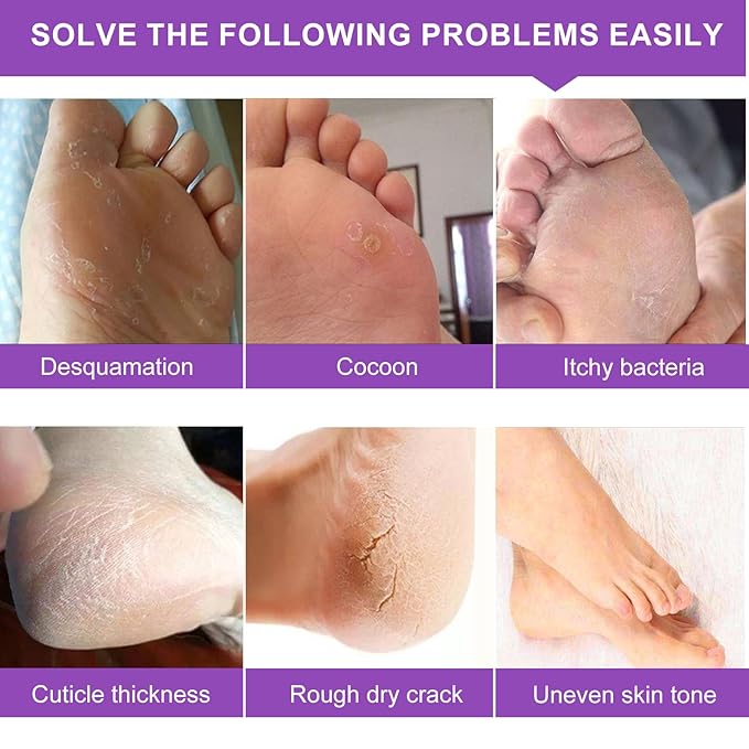 Foot Peeling Mask - 5 Pack, Exfoliating Mask Make Feet Baby Soft, Foot Mask for Dry Cracked Skin, Peeling Away Dead Skin, Calluses - Lavender