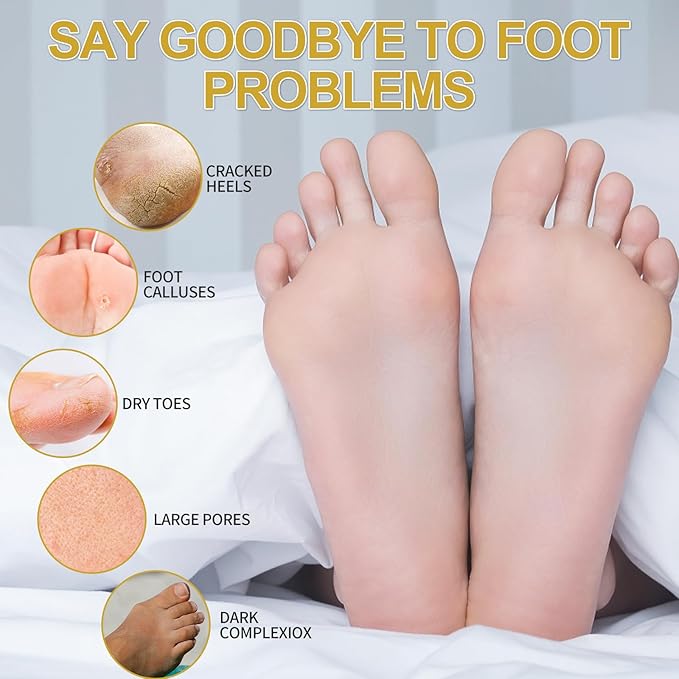 Pedicure Kit Foot Soak Set: Bubble Salt, Sugar Scrub, Massage Mask, Massage Lotion in a Box, 4 Step Foot Spa Kit for Dry Feet, Tired Feet（3 Set Honey flower)