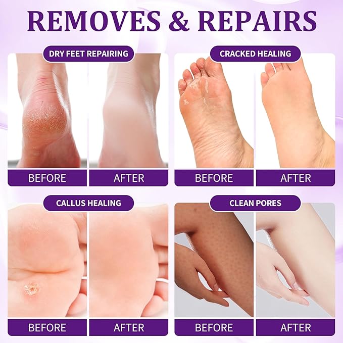 Pedicure Kit Foot Soak Set: Bubble Salt, Sugar Scrub, Massage Mask, Massage Lotion in a Box, 4 Step Foot Spa Kit for Dry Feet, Softens Calluses, Tired Feet（3 Set Lavender)